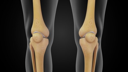 Human Patella or kneecap 3d illustration - obrazy, fototapety, plakaty