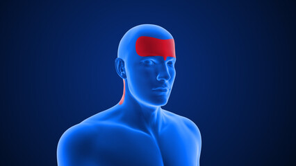 Types of Headache (Rebound) 3d illustration