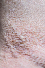 texture of the skin of people