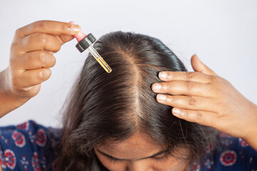 women suffering from hair loss using hair serum or minoxidil to treat alopecia