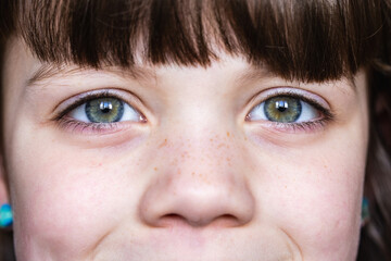 Close-up of child's freckled face with expressive eyes - 776990462
