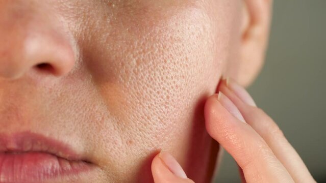 a close-up of the skin. Close-up of the skin. texture of oily skin with enlarged pores. The concept of problem skin care, modern Cosmetology Environmental influences