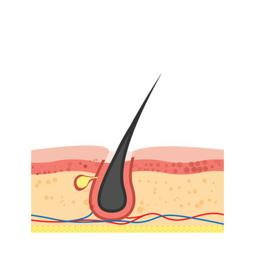 Human hair follicle. Hair loss problem. Vector illustration in flat style