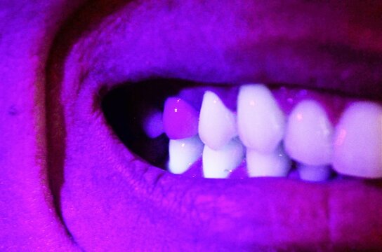 dentes UV