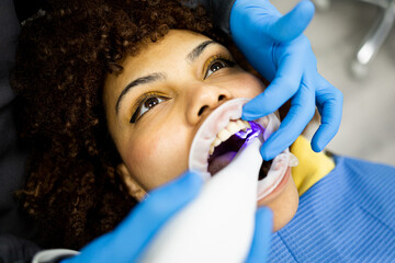 A dark-skinned woman with afro hair visits a dentist clinic. Detail of the Arab woman's mouth while a digital impression is made with an intraoral scanner.Intraoral 3D scanner concept.