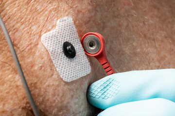 close up of attaching a red lead to an electrocardiography ECG EKG electrode for a heart monitor on...