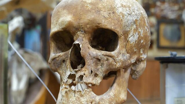 Human skull. Bones of human cranium