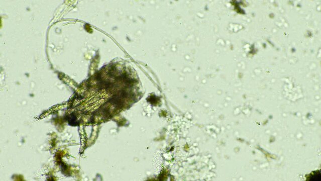 Soil microorganisms in a compost sample including bacteria, testate amoeba, flagellates. regenerative agricultural farm. Soil testing agriculture agronomy done for farmers for carbon sequestration