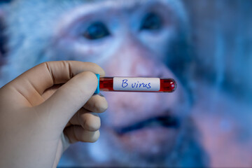 B Virus,herpes B, monkey B virus, Herpesvirus simiae,Herpes virus B,Macacine alphaherpesvirus 1 is the Simplexvirus infecting macaque monkeys.