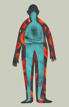 Mental Disorder concept: Dysmorphophobia or Anorexia nervosa