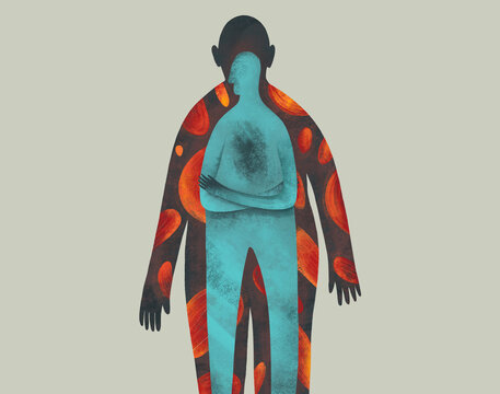 Mental Disorder concept: Dysmorphophobia or Anorexia nervosa