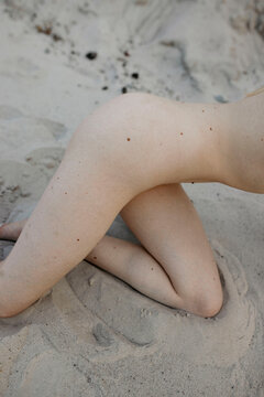 Detail-Close up photo of white skin texture with big moles on the hip