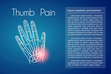 Hand pain linear icon on blue background. Vector abstract minimal illustration of a hand with red spot on it. Design template for medicine or therapy for thumb pain or carpal tunnel syndrome
