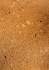 Skin Condition: Tinea Versicolor. Lack of pigmentation
