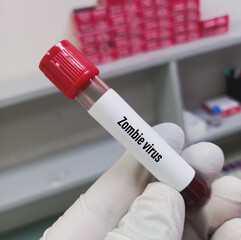 Blood sample for zombie virus test.