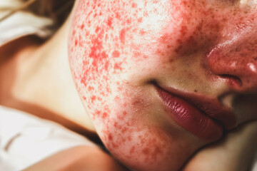 Close-up of a damaged face