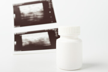 Abortion pills, contraceptive medicine, female care, options for reproductive health