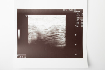 Pelvic ultrasound, gynecologist performing abdominal scan on female patient, medical diagnosis,...