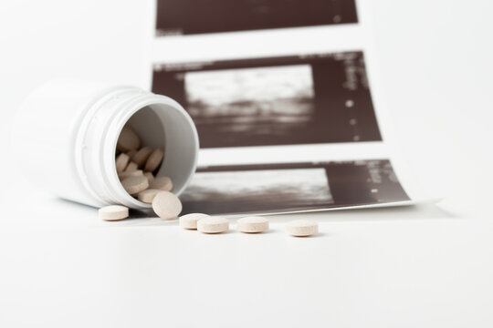 Abortion pills, healthcare decision, pharmacy counter, medication for termination