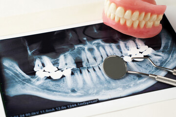 Dentures with Dental x-ray and dentist tool, close-up