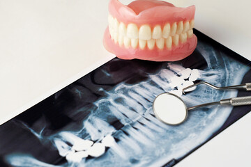 Dentures with Dental x-ray and dentist tool, close-up - 778760256