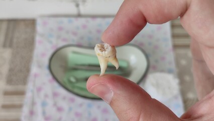 Dentist shows a removed tooth in hand