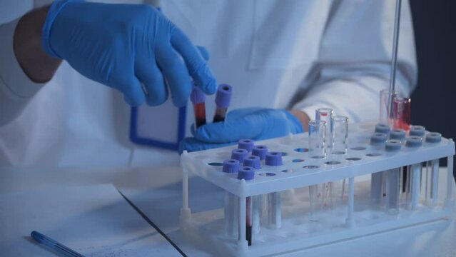 Scientist working with blood sample in laboratory. Lab analyst analyzes a blood slide. Doctor or pathologist drops a humans red blood on glass plate. Biological material to identify the virus. 