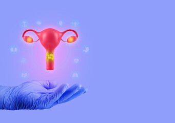 Cervical cancer concept, the uterus with damaged tissue. Doctor's hand shows female reproductive system isolated. Awareness to get the Pap test done. Isolated on light violet background - obrazy, fototapety, plakaty