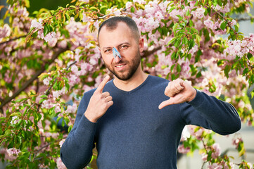 Man allergic suffering from seasonal allergy at spring. Bearded man with clothespin clipped to his nose - symbolic gesture of his inability to breathe due to nasal congestion, giving thumbs down. - obrazy, fototapety, plakaty