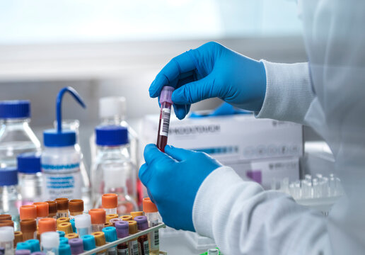 Scientist holding blood sample tube in laboratory