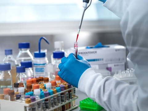 Pathologist pipetting blood sample in test tube at laboratory