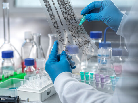 Hands of scientist examining DNA electrophoresis data in laboratory