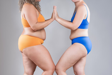 Two overweight women with cellulitis, fat flabby bellies, legs, hands, hips and buttocks on gray background, obese female body, liposuction and plastic surgery concept - 779509856