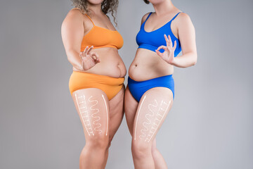 Two overweight women with cellulitis show ok, fat flabby bellies, legs, hands, hips and buttocks on gray background, obese female body, liposuction and plastic surgery concept - 779509882