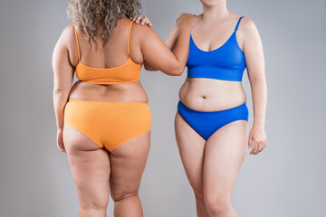 Two overweight women with cellulitis, fat flabby bellies, legs, hands, hips and buttocks on gray background, obese female body, liposuction and plastic surgery concept - 779510033