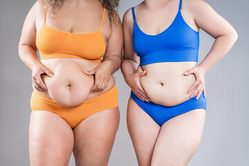 Two overweight women with cellulitis, fat flabby bellies, legs, hips and hands on gray background,...