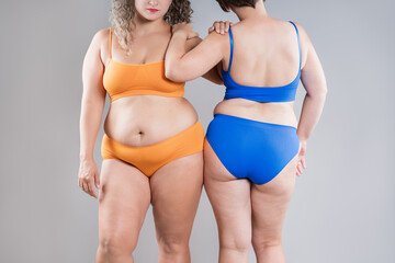 Two overweight women with cellulitis, fat flabby bellies, legs, hands, hips and buttocks on gray background, obese female body, liposuction and plastic surgery concept - 779510065