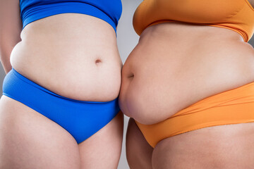 Tummy tuck, two fat women with cellulitis and flabby bellies on gray background, obese female body, plastic surgery and liposuction concept - obrazy, fototapety, plakaty