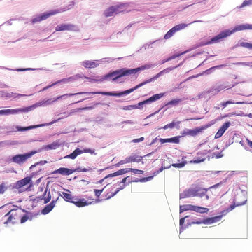 This photo shows simple squamous epithelial cells on the surface of the human great artery, which has the functions of exchange and secretion.