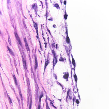 This photo shows simple squamous epithelial cells on the surface of the human great artery, which has the functions of exchange and secretion.