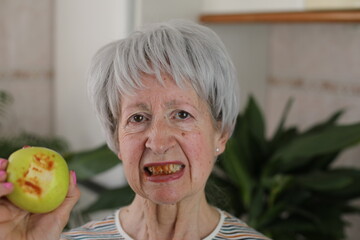 Senior woman with bloody gums after bitting an apple 