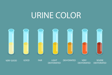 3D Isometric Flat Vector Illustration of Urine Color Chart, Assessing Hydration and Dehydration - 779920891