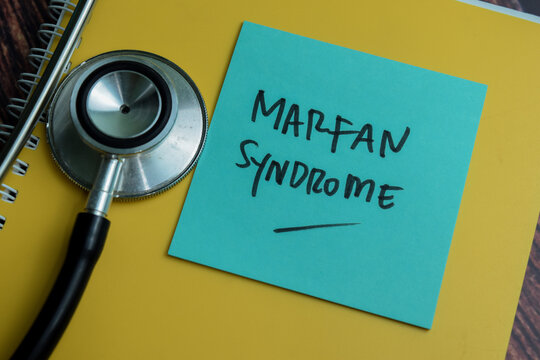 Concept of Marfan Syndrome write on sticky notes with stethoscope isolated on Wooden Table.