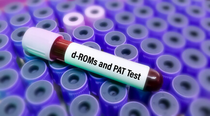 d-ROMs (derivatives-reactive oxygen metabolites) PAT (plasma antioxidant capacity) tests are...