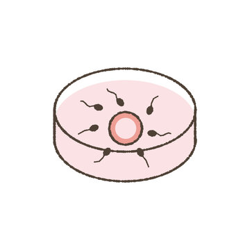 Artificial insemination illustration.
