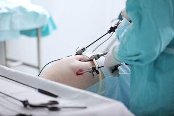 Laparoscopic instruments in the hands of a surgeon. Laparoscopic surgery. Surgery through small...