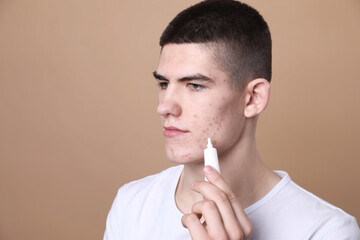 Young man with acne problem applying cosmetic product onto his skin on beige background. Space for...