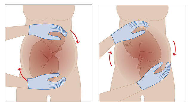 flip a breech