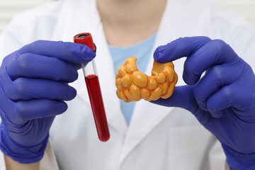 Endocrinologist showing thyroid gland model and blood sample in test tube, closeup
