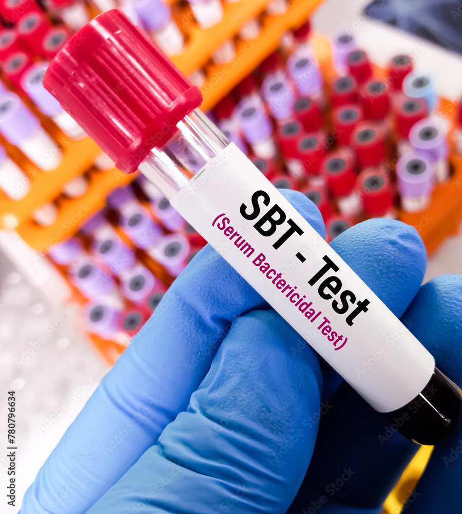 Poster Blood sample for Serum Bactericidal Test (SBT), to determine maximum bactericidal dilution of serum after administration of antibiotics.